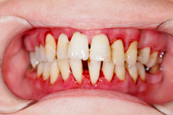 Dentist Kelowna | Dr. Sandy Crocker, Dr. Peter Mitchell | Dentists Kelowna | Dr. Sandy Crocker, Dr. Peter Mitchell & Associates